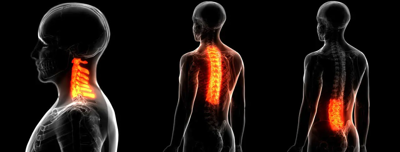 Dolor de espalda en el taxi