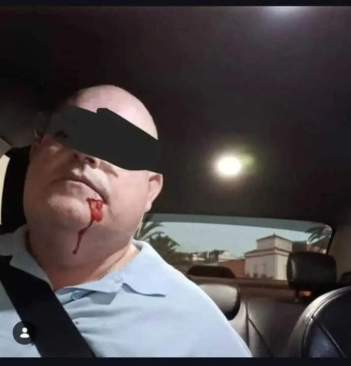 Taxista agredido en Las Palmas de Gran Canaria