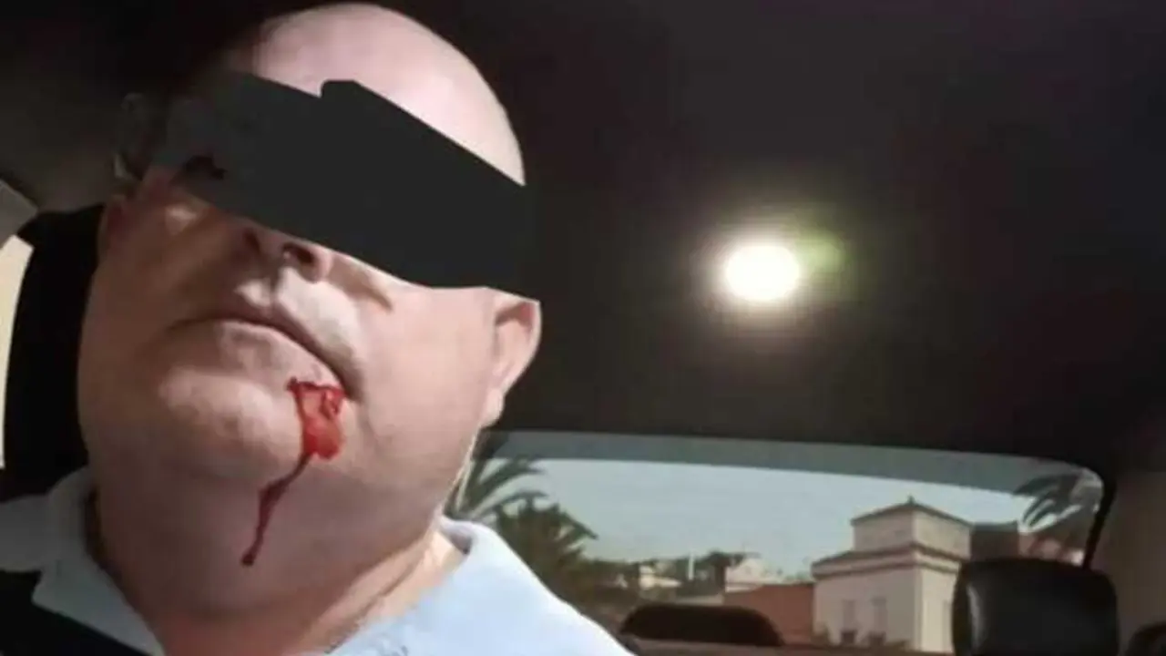Taxista agredido en Las Palmas de Gran Canaria